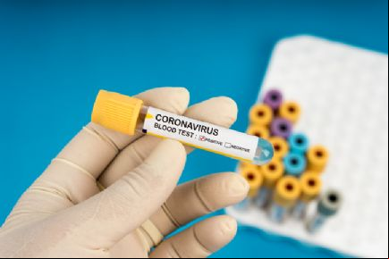 Confresa tem 74 moradores em isolamento domiciliar; nenhum mun