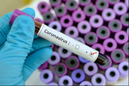Vila Rica registra 6 casos positivos e 7 casos suspeitos de coronav